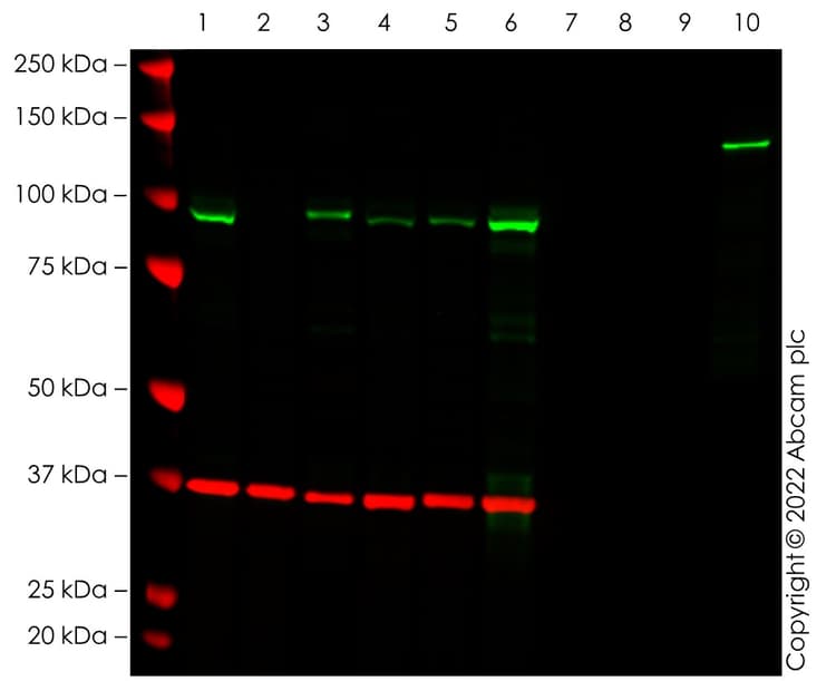 Anti-SATB2 antibody [EPNCIR130A] - BSA and Azide free(AB212177)