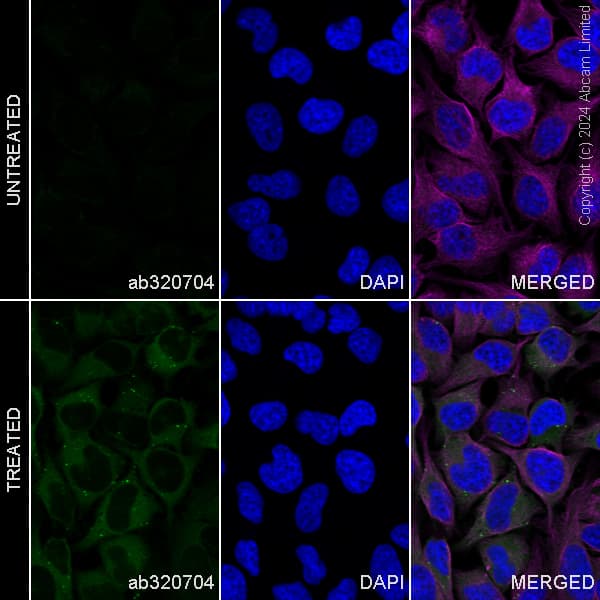 Alexa Fluor 488 Gbp1 Antibody Epr8285 Ab320704  Immunocytochemistry Immunofluorescence Img434961
