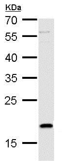 Anti-TSLP antibody(AB184638)
