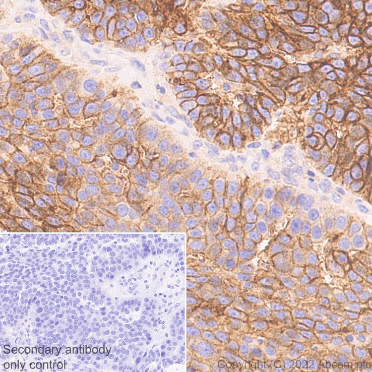 Cd47 Antibody Epr24922 5 Ab300435  Immunohistochemistry Formalin Pfa Fixed Paraffin Embedded Sections Img400680