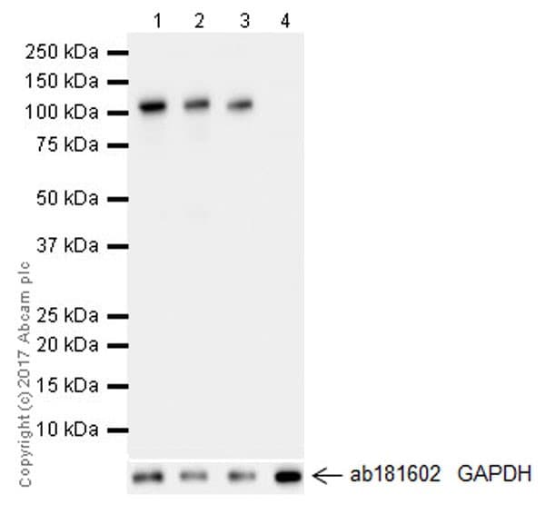Anti-Hexokinase II antibody [EPR20839](AB209847)