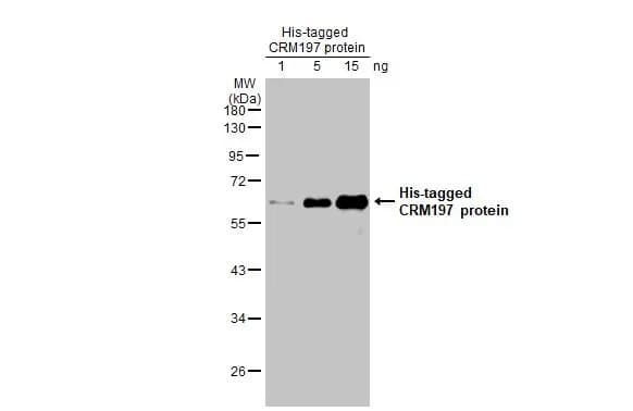 Anti-CRM197 antibody [HL1808](ab308402)
