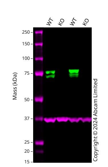 Anti-FMRP antibody(AB17722)