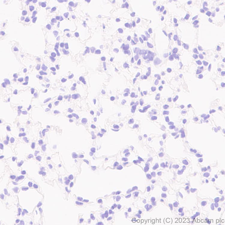 Anti-Homeobox protein cut-like 2 antibody [EPR26509-79](AB315796)
