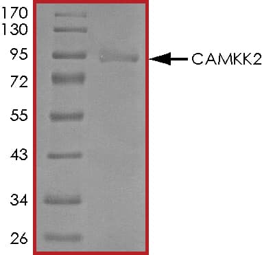 Recombinant human CAMKK2 protein (Active)(ab268380)