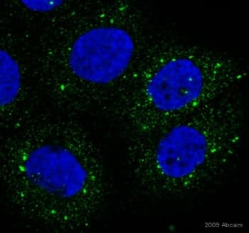 Anti-P4HB antibody [RL90](AB2792)