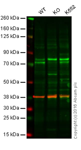 Samhd1 Antibody Oti1a1 Ab128107  Western Blot Img99194