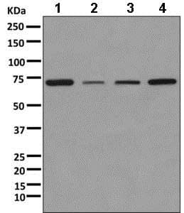 Kbtbd11 Antibody Epr100562b Bsa And Azide Free Ab249501  Western Blot Img105041