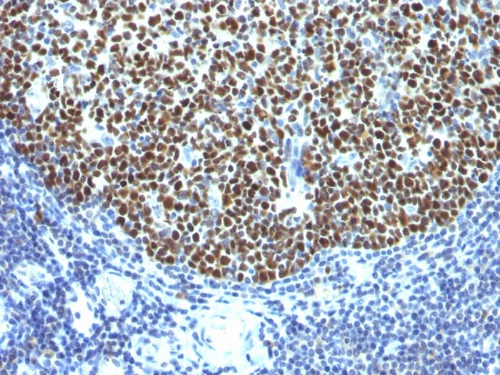Bcl6 Antibody Spm602 Ab270713  Immunohistochemistry Formalin Pfa Fixed Paraffin Embedded Sections Img101347