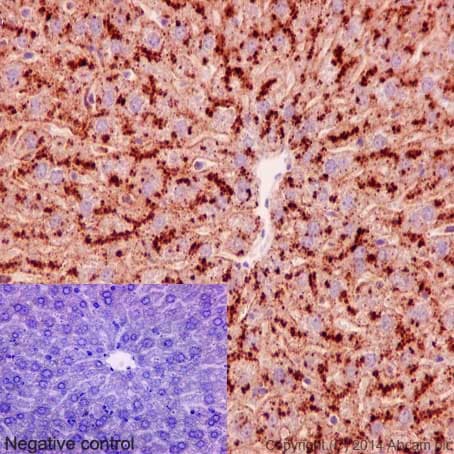 Anti-Niemann Pick C1 antibody [EPR5209] - BSA and Azide free(AB224268)