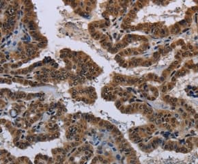 Anti-n-Myc/MYCN antibody(AB198912)
