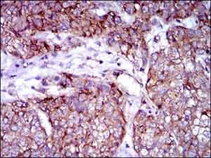 Rex1 Antibody 5e11e7 Ab175431  Immunohistochemistry Formalin Pfa Fixed Paraffin Embedded Sections Img39937