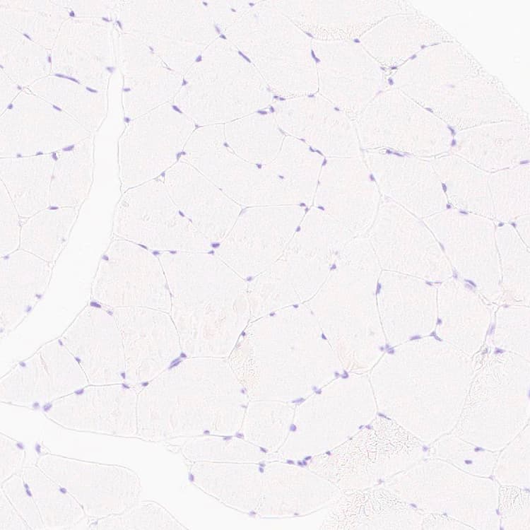 Anti-MYBPC3 antibody [EPR25673-58](AB308619)