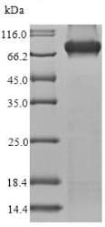 Recombinant Human Methylmalonyl Coenzyme A mutase protein (His tag)(AB235808)
