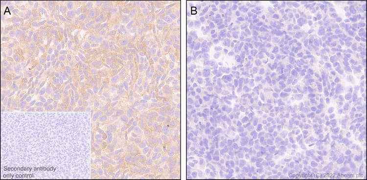 Anti-PAK1 antibody [EPR26067-45](AB302506)
