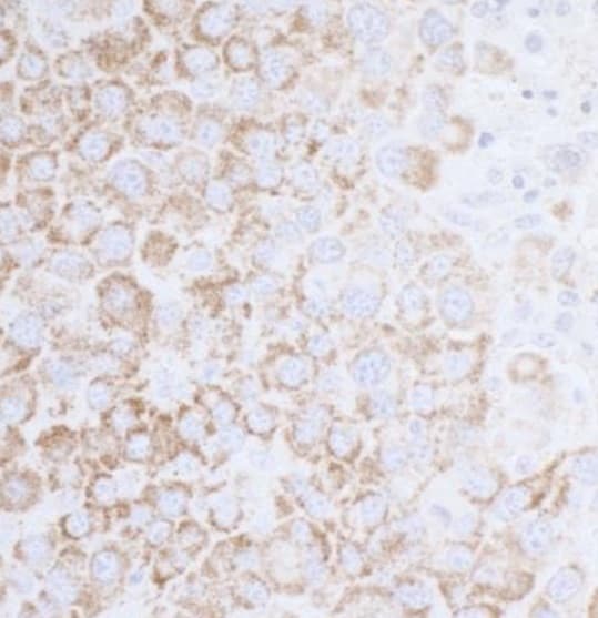 Anti-ATP5A antibody(AB245580)