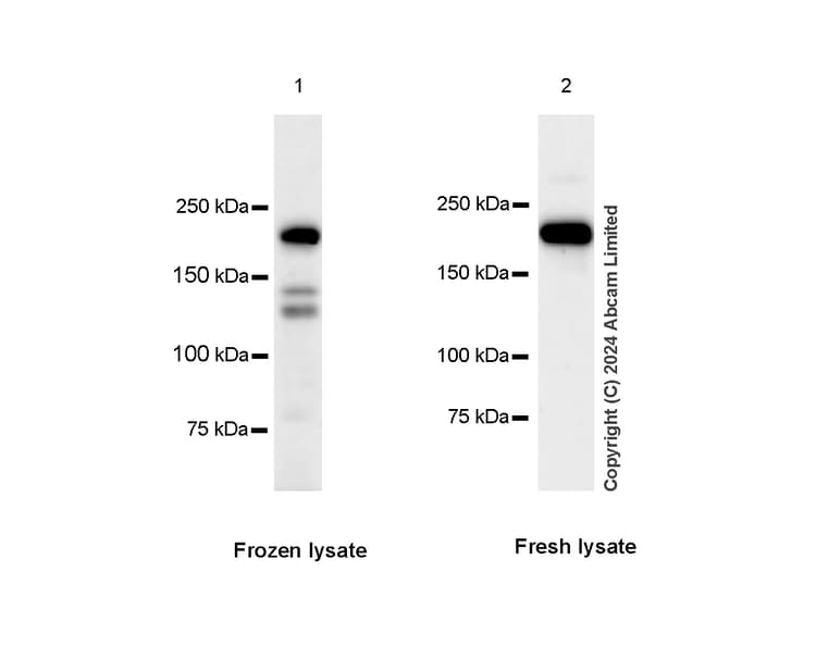 Dnmt1 Antibody Rm1192 Ab317845  Western Blot Img434402