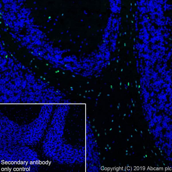 Anti-SOX10 antibody [EPR4007](AB155279)