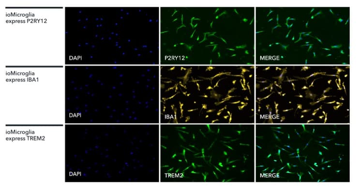 Iomicroglia Human Ipsc Derived Cells Ab317488  Immunocytochemistry Immunofluorescence Img429728