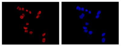 Anti-PHOX2B antibody [EPR14423] - C-terminal(AB183741)