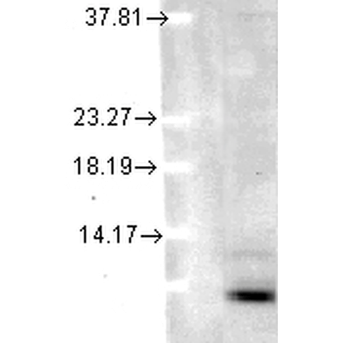 Anti-Ubiquitin antibody [5B9-B3](AB223378)