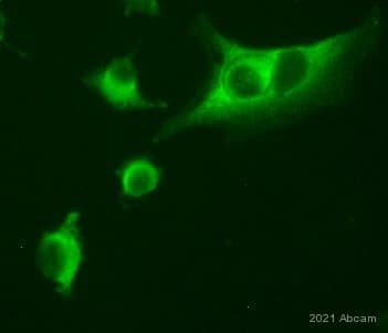 Anti-LDL Receptor antibody(AB30532)