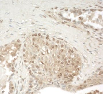 Zch11 Antibody Ab128180  Immunohistochemistry Formalin Pfa Fixed Paraffin Embedded Sections Img101514