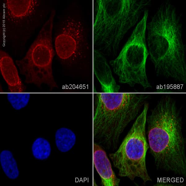 Alexa Fluor 647 Rangap1 Antibody Epr3295 Ab204651  Immunocytochemistry Immunofluorescence Img20485