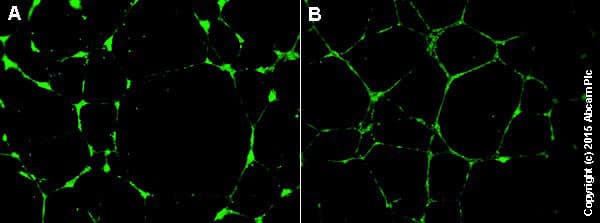 Angiogenesis Assay Kit (In Vitro)(AB204726)