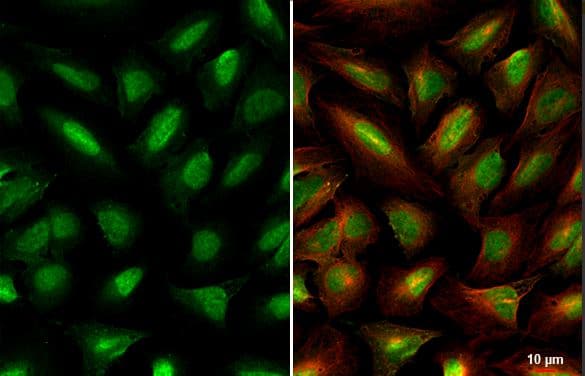 Miz1 Antibody Hl1548 Ab308167  Immunocytochemistry Immunofluorescence Img407036