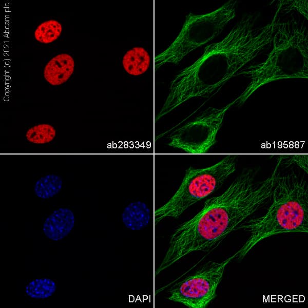 Alexa Fluor® 647 Anti-Histone H3 (mono methyl K4) antibody [ERP16597](AB283349)
