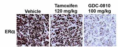 Anti-Estrogen Receptor alpha antibody [SP1](AB16660)