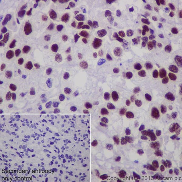 Anti-Steroidogenic Factor 1/SF-1 antibody [EPR19744](AB217317)