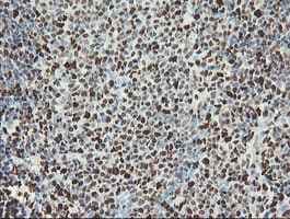 Samhd1 Antibody Oti1a1 Ab128107  Immunohistochemistry Formalin Pfa Fixed Paraffin Embedded Sections Img135318