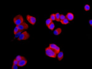 Anti-Ribosomal protein S11/RPS11 antibody [EPR11487](AB175213)