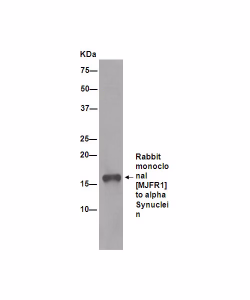 Alpha Synuclein Antibody Mjfr1 Bsa And Azide Free Ab209420 Immunoprecipitation Img759