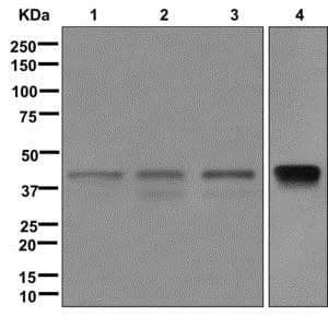 Anti-Islet 1 antibody [EPR10362](AB178400)