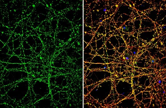 Anti-Nav1.7 antibody(AB272931)