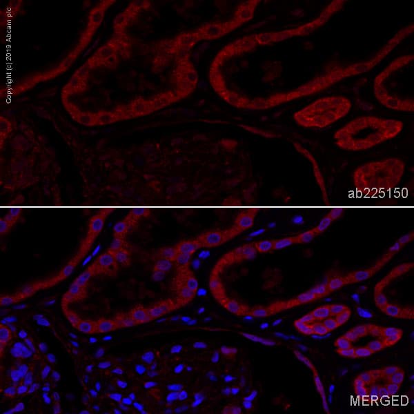 Anti-GBA antibody [EPR5143(3)] - BSA and Azide free(AB215260)