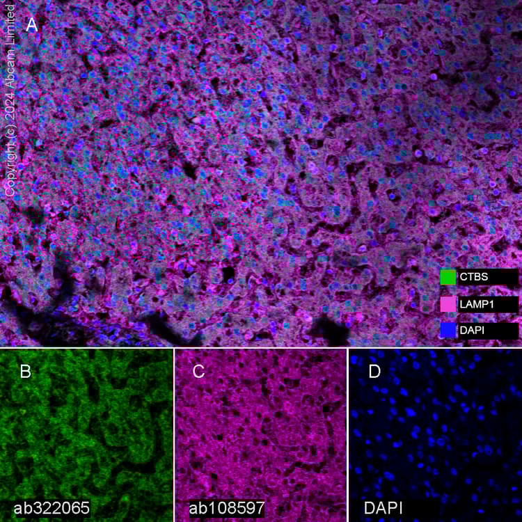Anti-LAMP1 antibody [EPR4204] - Lysosome Marker(AB108597)