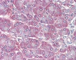 Rbp1 Antibody Ab104452  Immunohistochemistry Formalin Pfa Fixed Paraffin Embedded Sections Img85468