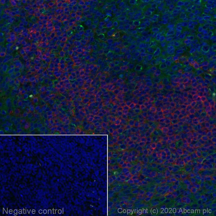 Alexa Fluor 647 Ccr7 Antibody Epr23192 57 Ab275165  Immunohistochemistry Formalin Pfa Fixed Paraffin Embedded Sections Img124326