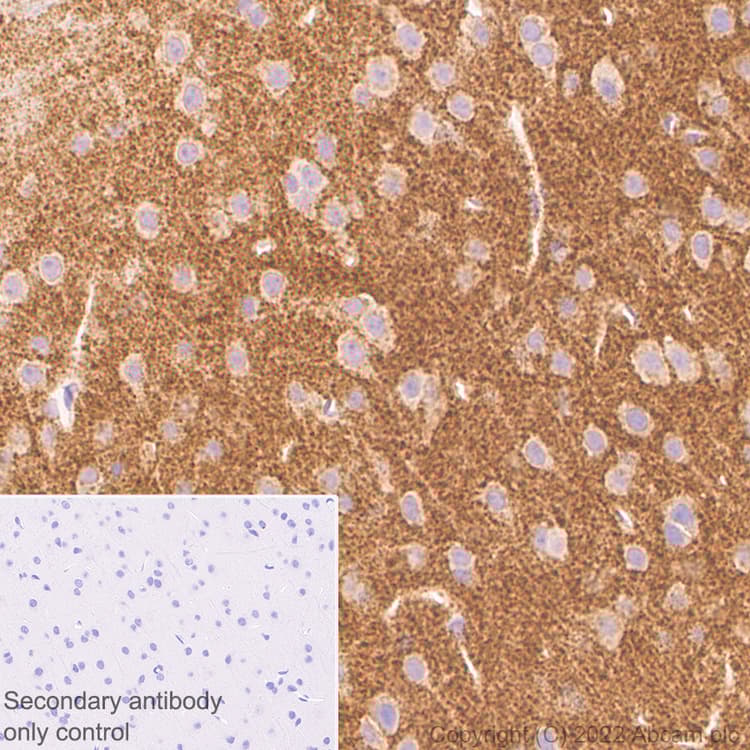 Anti-Bassoon/BSN antibody [L124-59](AB306593)