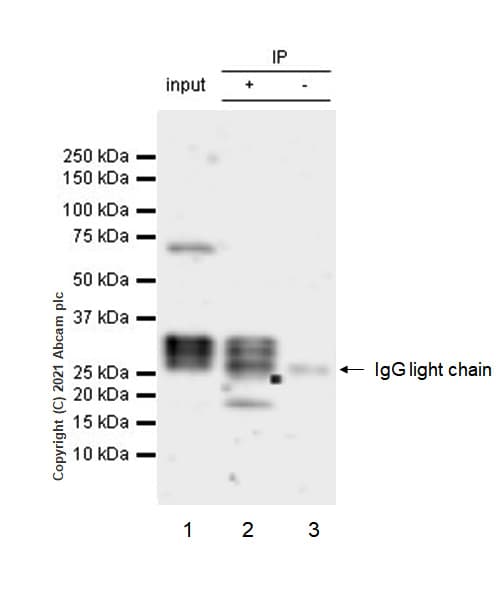 Anti-IL-1 beta antibody [RM1009](AB283818)