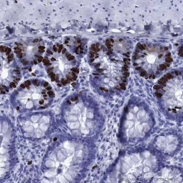 Anti-BrdU antibody [BU1/75 (ICR1)] - Proliferation Marker(AB6326)