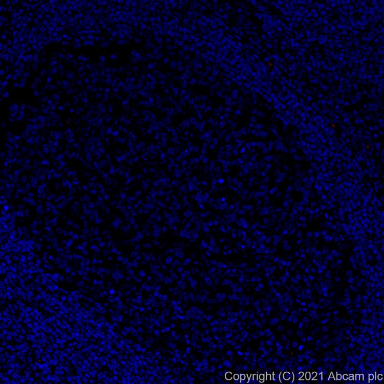 Alexa Fluor® 555 Anti-ErbB2 / HER2 antibody [EP1045Y](AB281782)