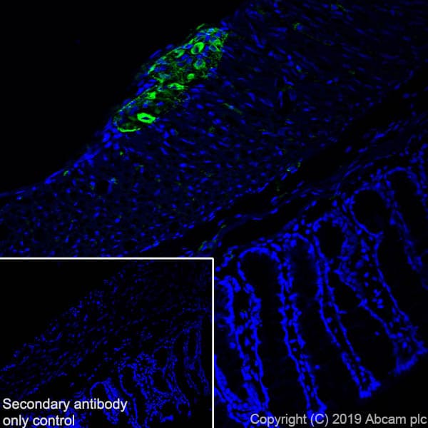 Anti-Peripherin antibody [EPR23445-28] - BSA and Azide free(AB269861)