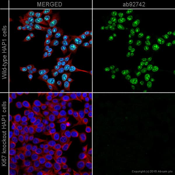 Anti-Ki67 antibody [EPR3610](AB92742)