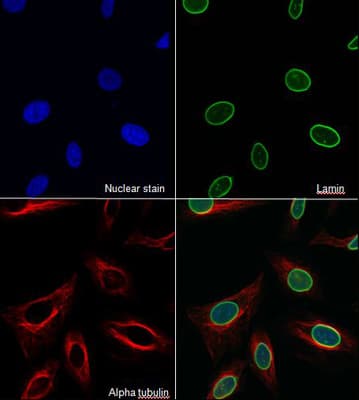 Goat Anti-Mouse IgG H&L (Alexa Fluor® 647)(AB150115)