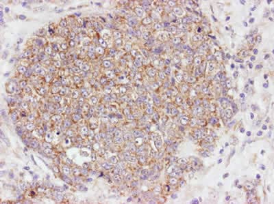 Anti-AKT1 (phospho S473) antibody(ab8932)